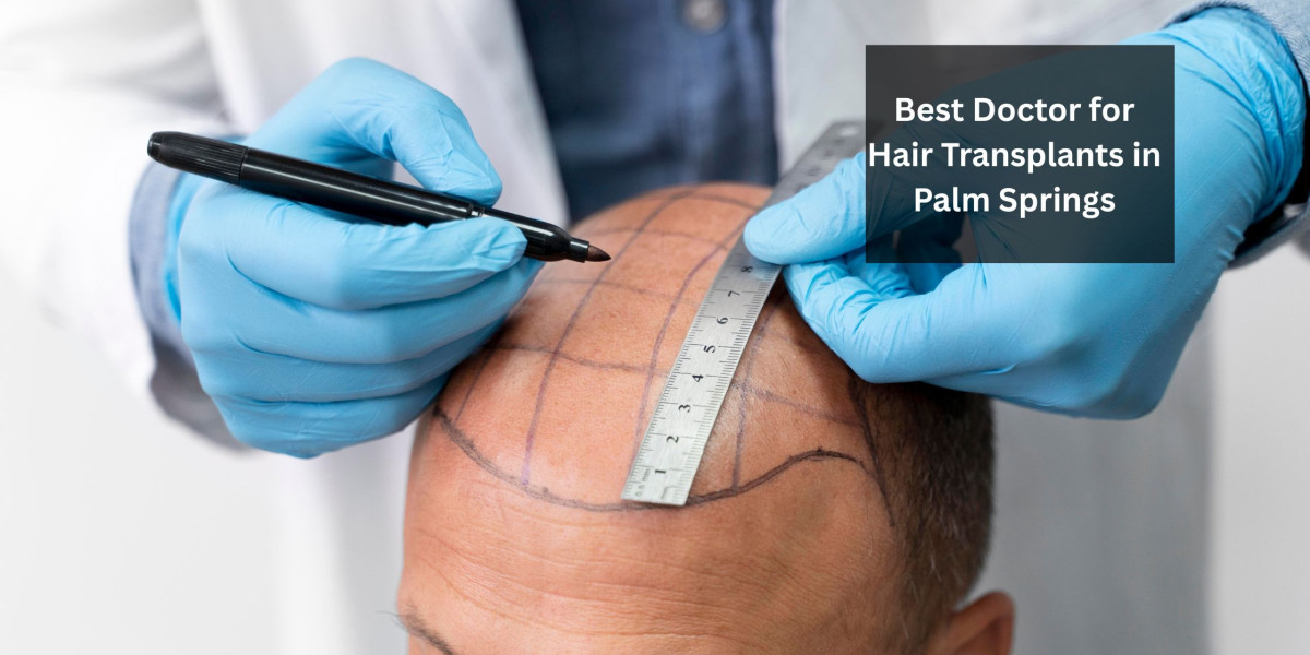 Best Doctor for Hair Transplants in Palm Springs
