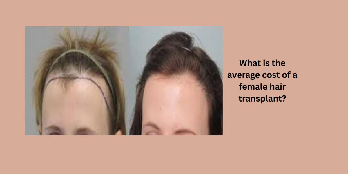 What is the average cost of a female hair transplant?